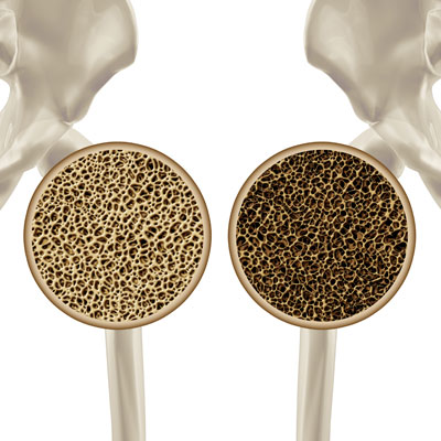 Kadınların Korkulu Rüyası: Menopoz / Opr.Dr. Süleyman Akarsu