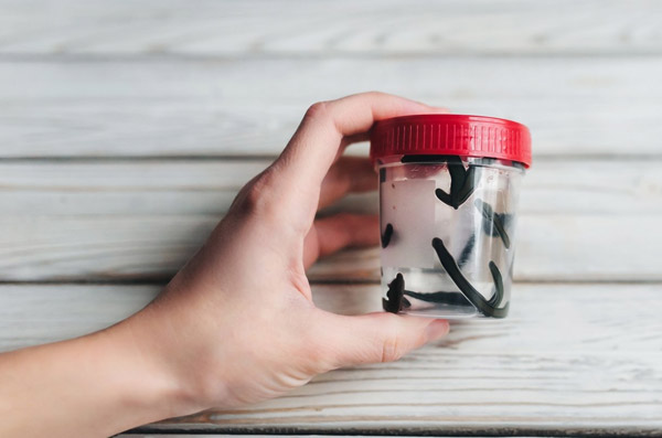 Sülük Tedavisi / Dr. Hasan Mücahit Bilecen